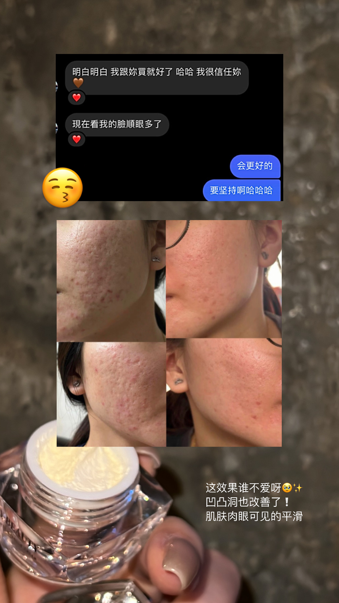 胎盘膏 38g正装大瓶