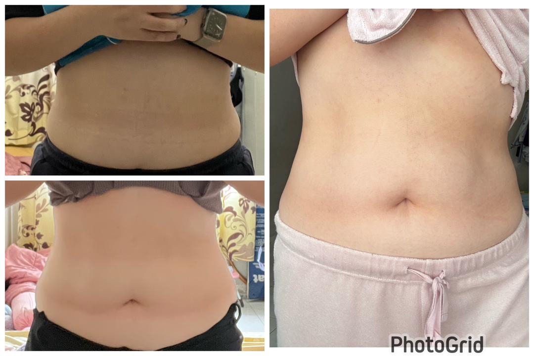 🇲🇾 5 盒 完整一个疗程配套 （ 可服用 30-45 天 ）