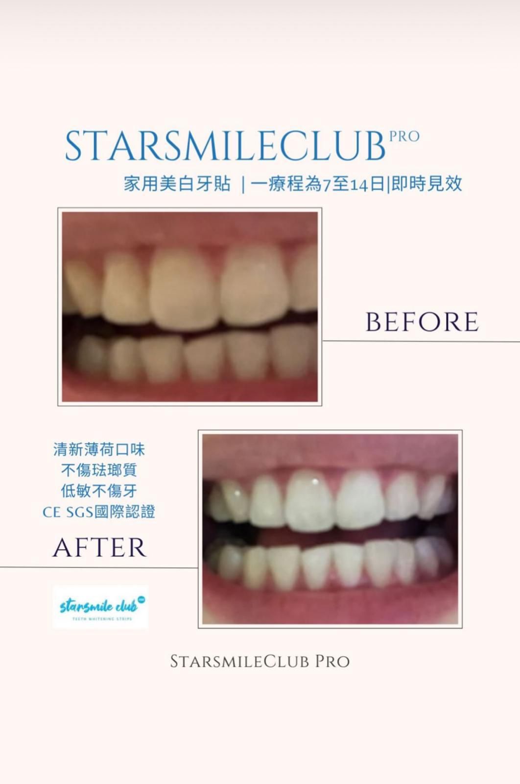 𝐒𝐭𝐚𝐫𝐬𝐦𝐢𝐥𝐞𝐂𝐥𝐮𝐛 𝐏𝐫𝐨 專業🇺🇸美白牙齒貼 （7p) ✅ 現貨 ✅ ‼️ 售完即止‼️