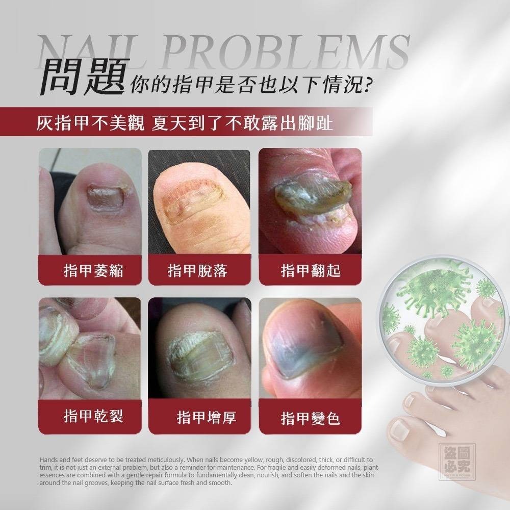 $58支。2支起$48支。台灣生醫廠 灰指甲滋養膏15ml