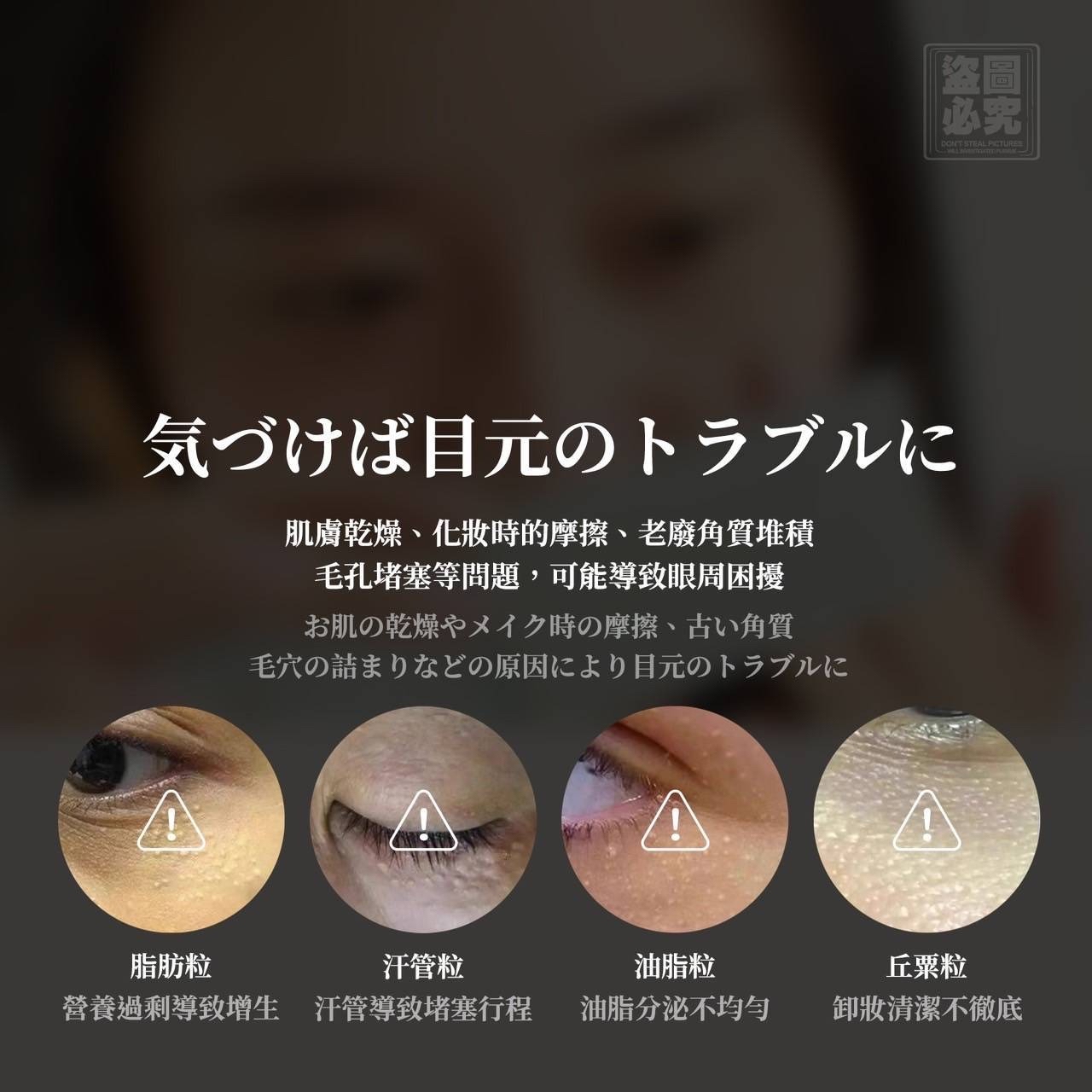 （約5月中到貨）🇯🇵日本平替款祛肉芽脂肪粒神奇眼霜15ml 💕