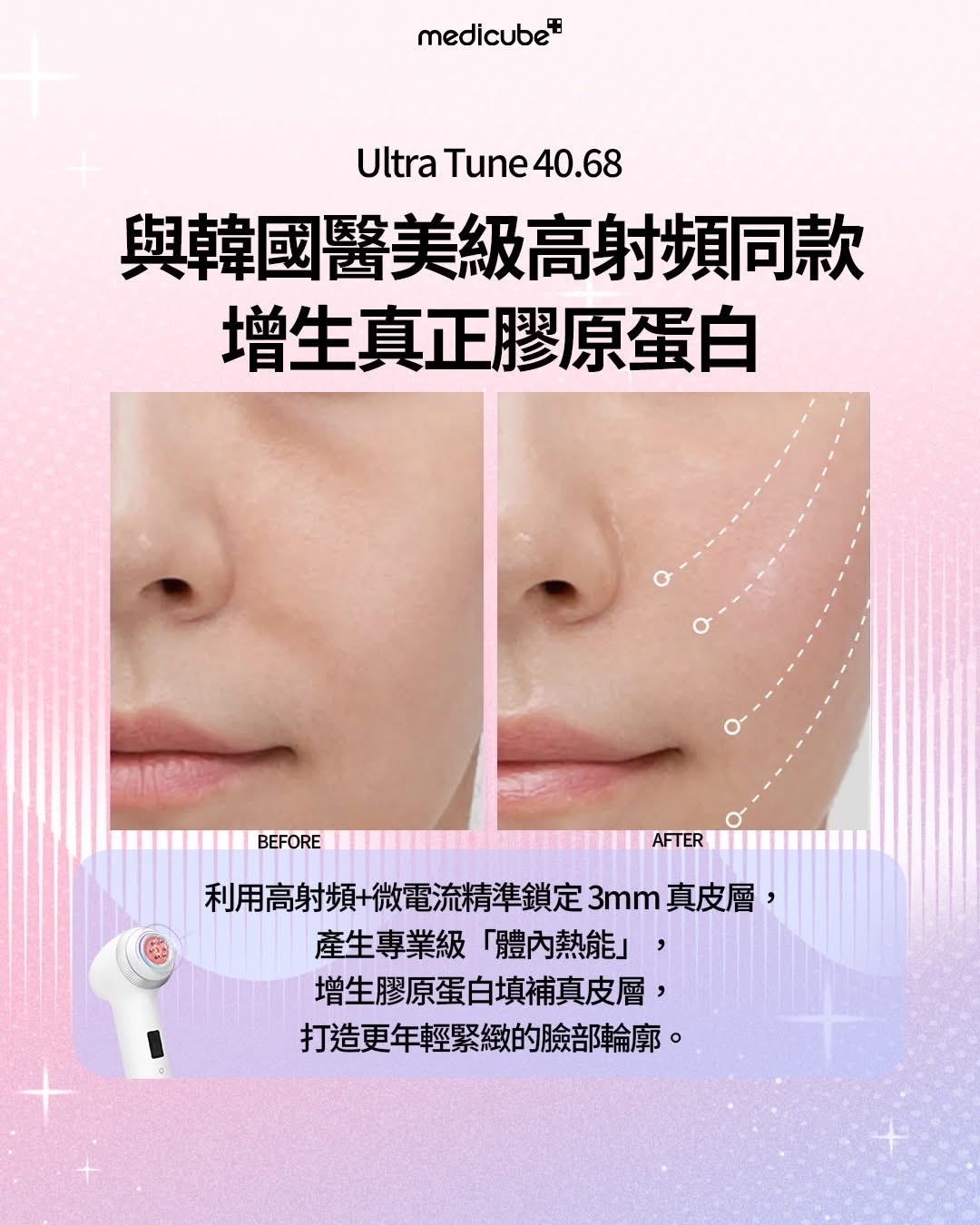 預訂預訂 MEDICUBE AGE-R High Focus Shot Plus [緊緻煥顏] 