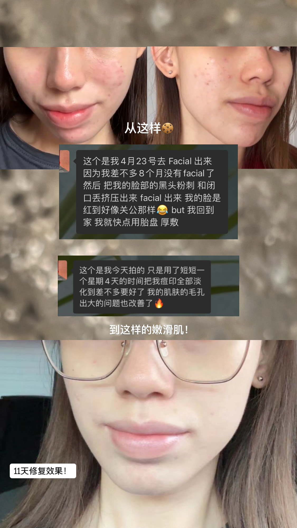 胎盘膏 38g正装大瓶