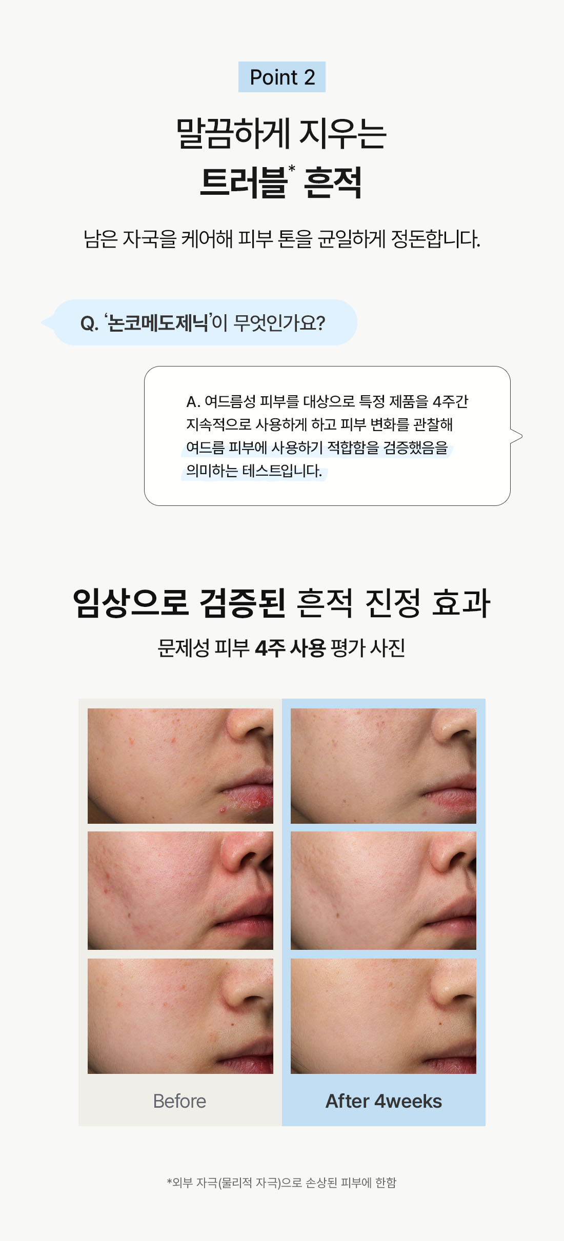韓國 Dr.Althea 345 Relief Cream 祛痘印舒緩保濕救世主面霜 50ml