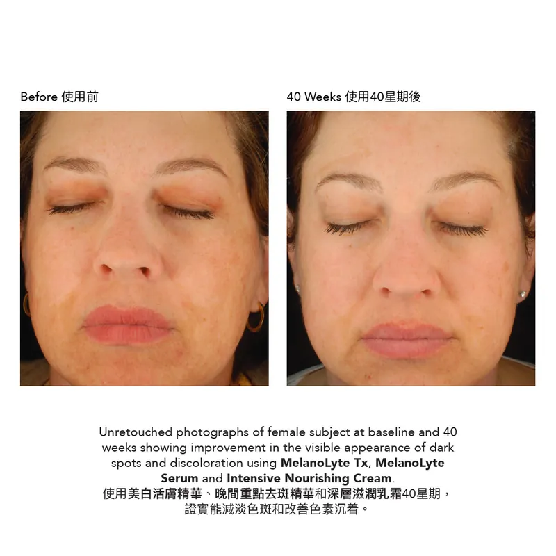 Epionce MelanoLyte Serum 晚間重點去斑精華 BBE 7/26