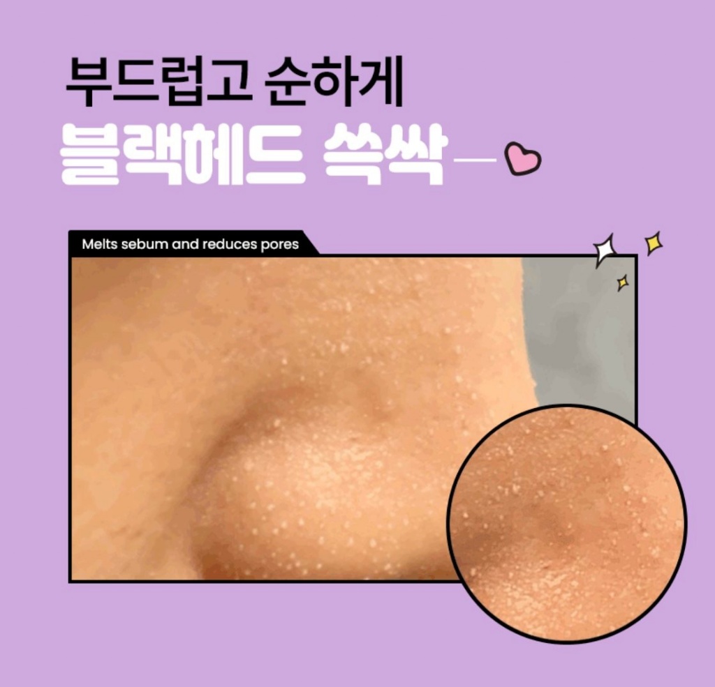 YW260687 - 韓國 ilso 聯名款去黑頭鼻貼-5組/盒