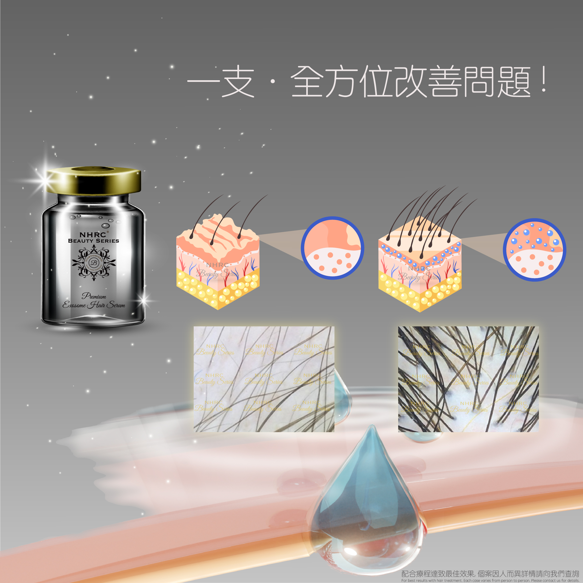 外泌體頭髮精華 Premium Exosome Hair Serum