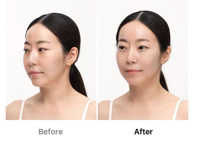 預訂預訂 Medicube AGE-R Ultra Tune 40.68 MHz高頻（RF）