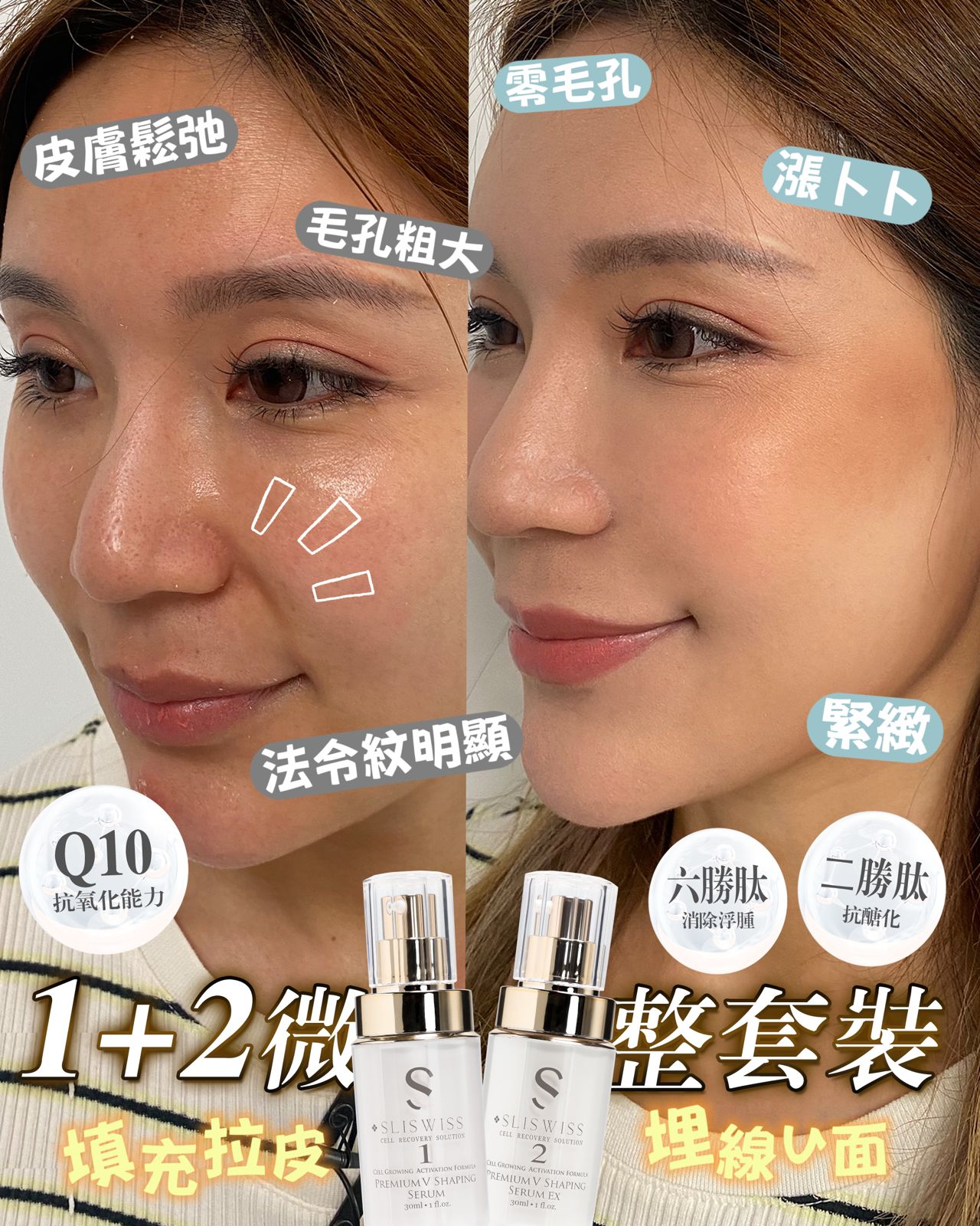 瑞士Sliswiss Plus 微整1+2套裝 （填充拉皮精華+埋線V面精華)  (訂貨7-10天)