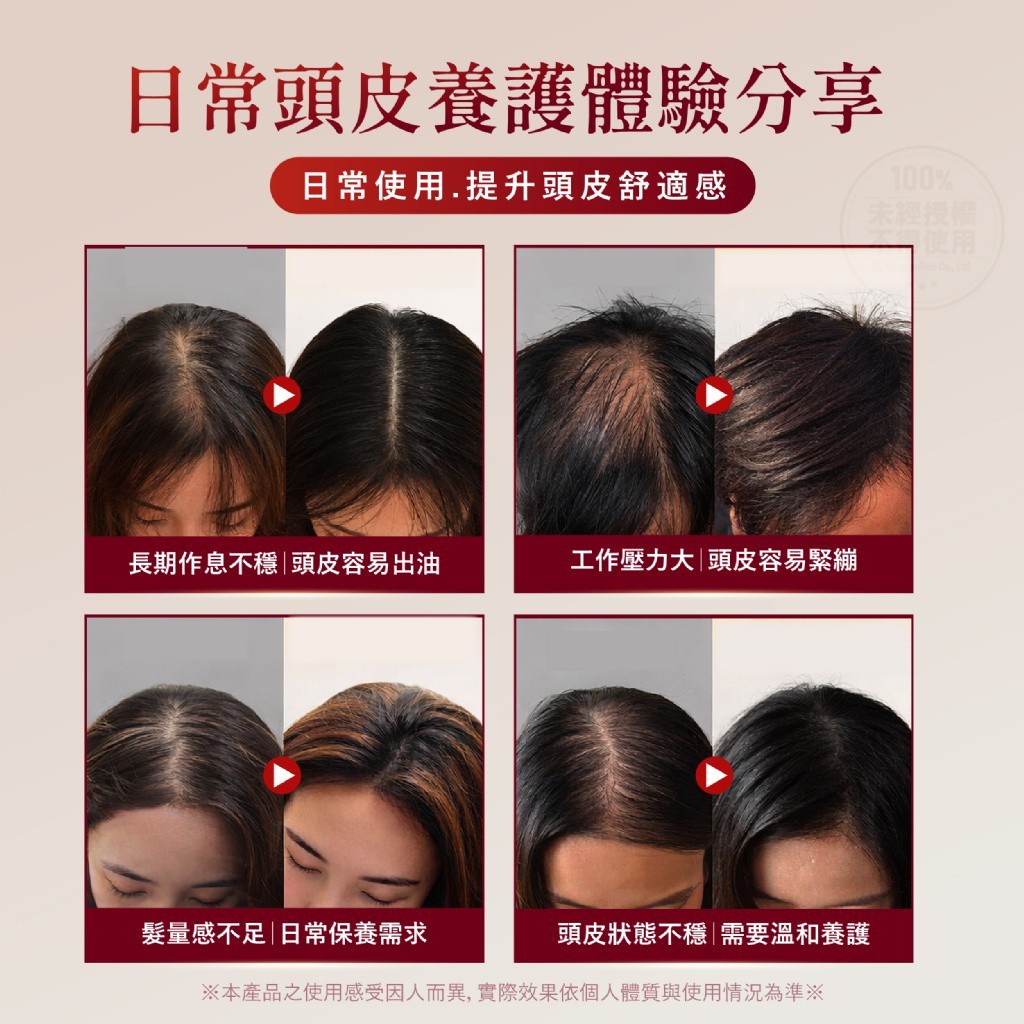 YW260526 - Medimetry® EMS微電流紅光頭皮理療按摩梳