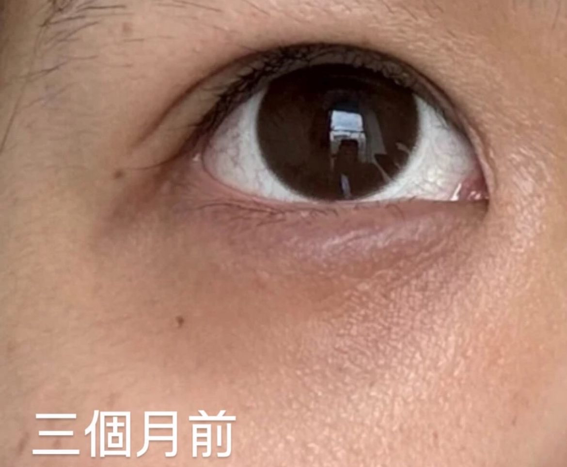 HADARiKi｜去黑眼圈/眼紋專用眼霜系列