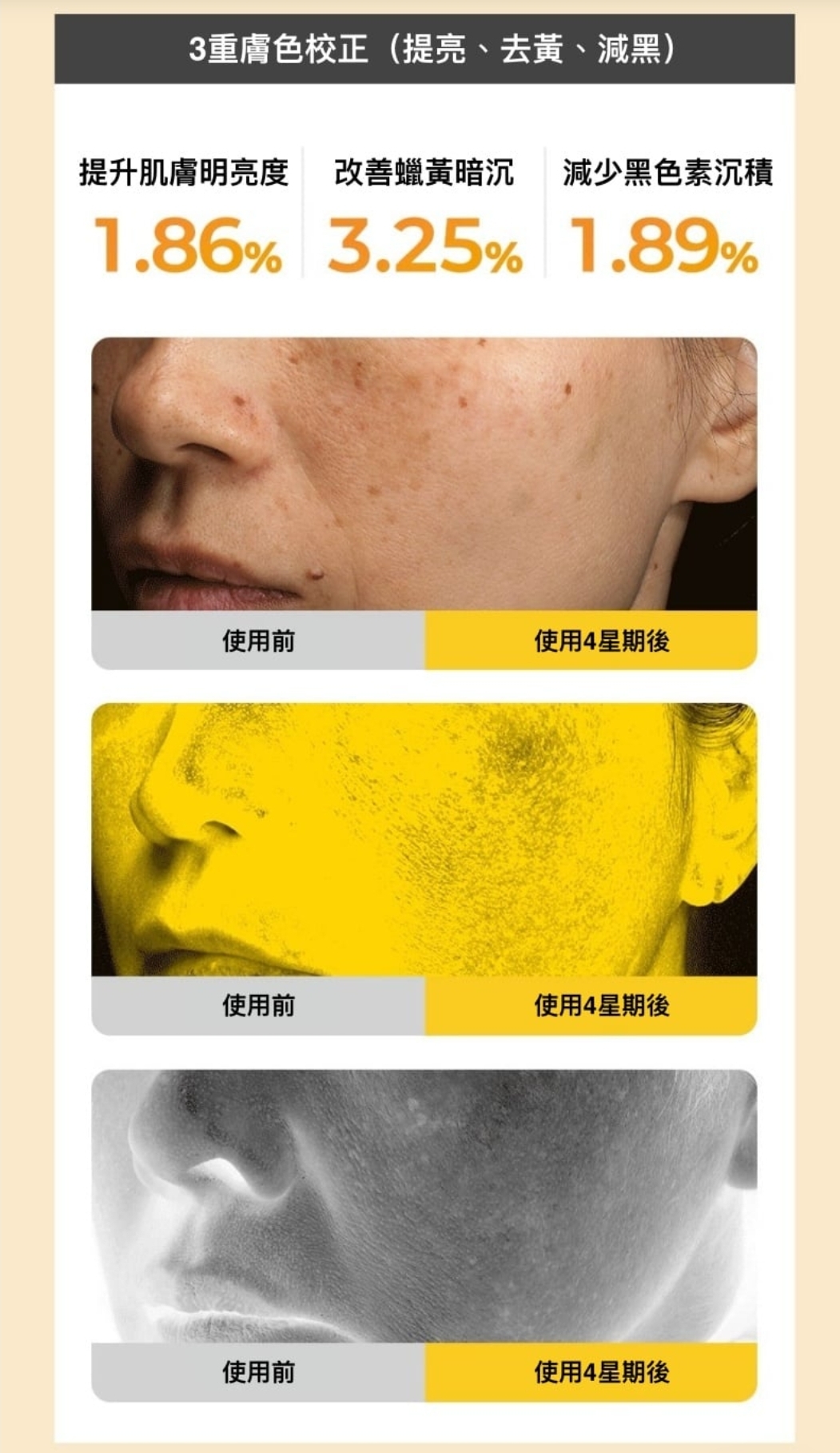 韓國🇰🇷直送✈️RIRE TRANEX 煥白淡斑精華霜10g