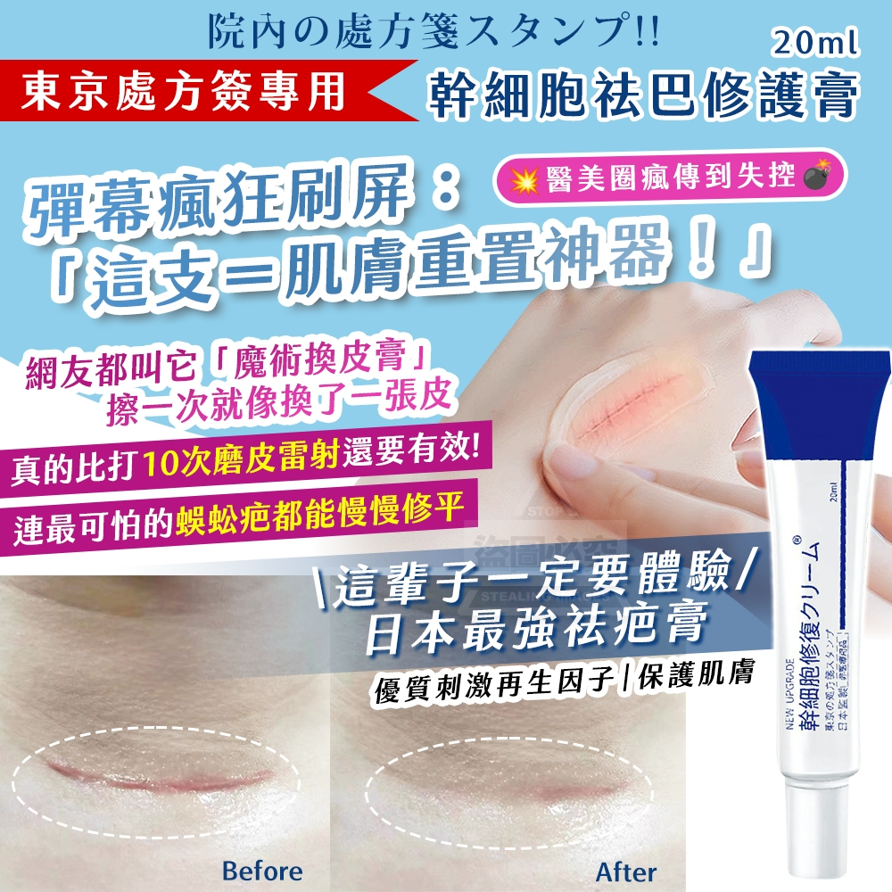 YW260576 - 東京處方簽專用｜幹細 胞祛巴修護膏 20ml