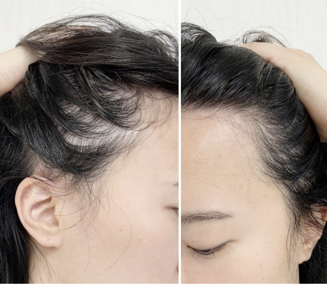 韓國 Epais 強韌髮根 頭皮精華 150ml ｜Scalp Boosting Ampoule 