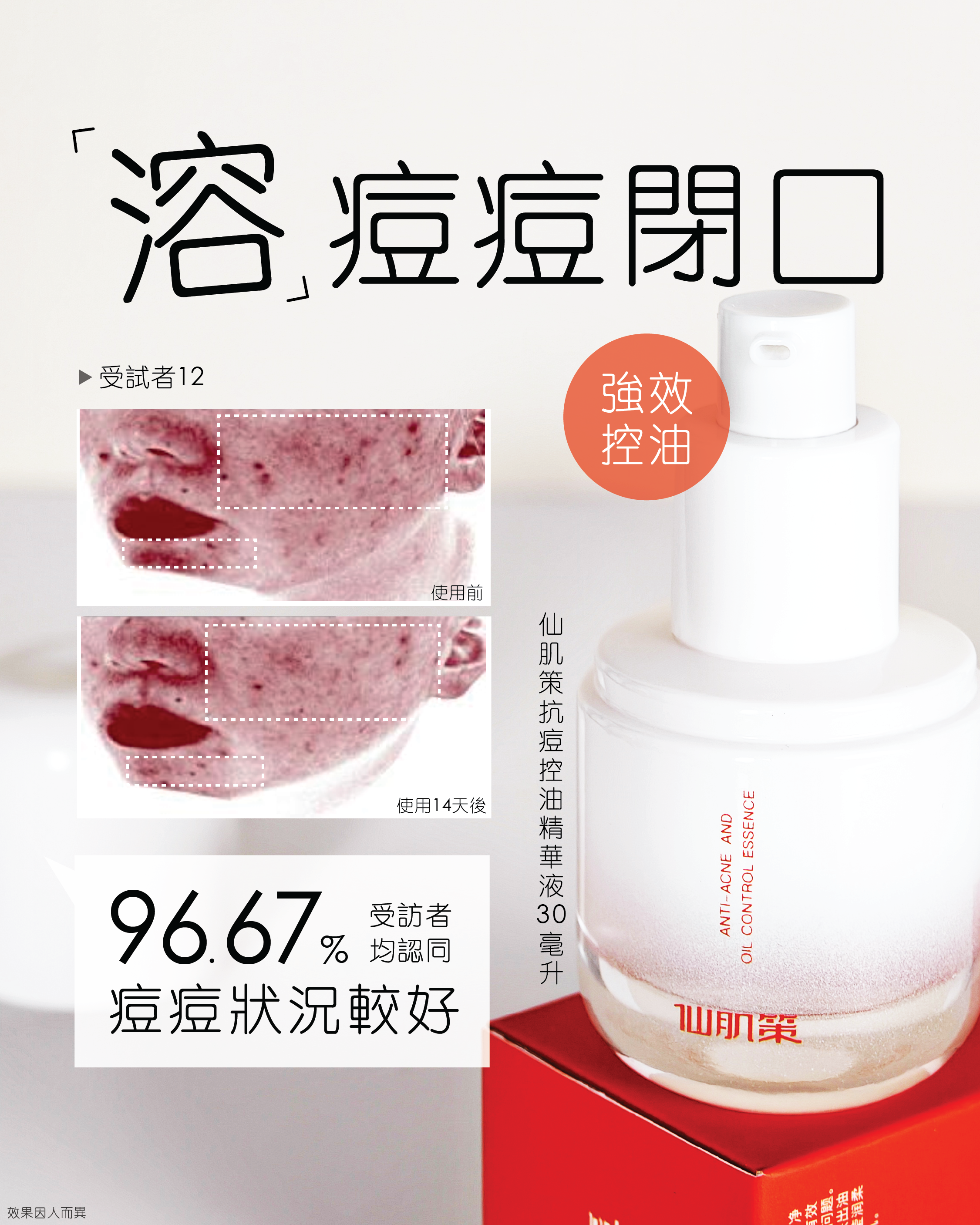 7折！仙肌策暗瘡護理套裝(全套4件)