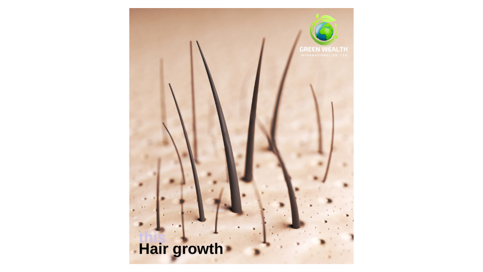 https://www.greenwealthinternational.com/wp-content/uploads/2024/11/hair-growth.png
