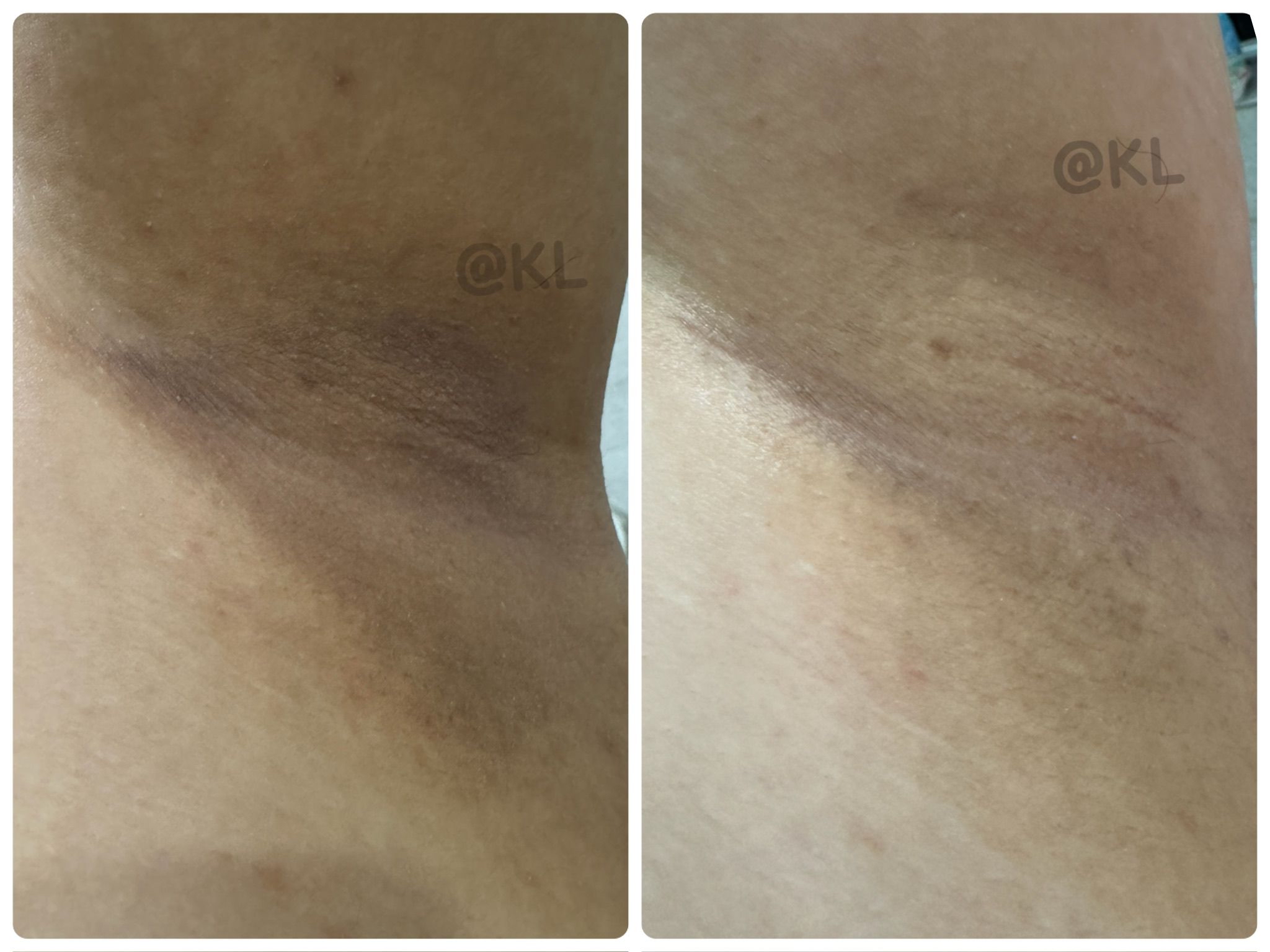 泰國🇹🇭直送@限時預購🔛The Original腋下美白霜