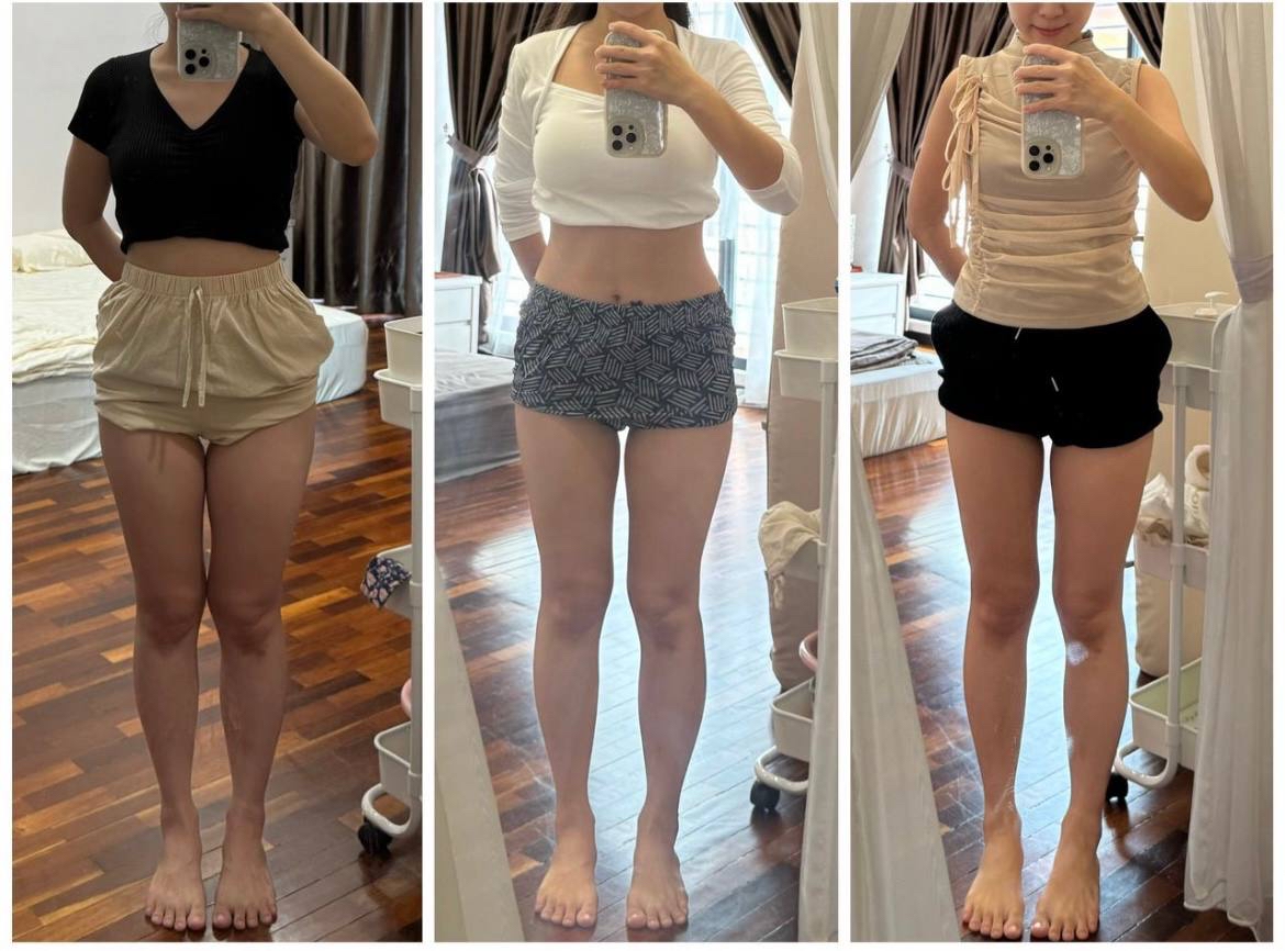 🇲🇾 20 盒 SUPER VVIP 疗程配套（ 可服用 120-135 天 ）