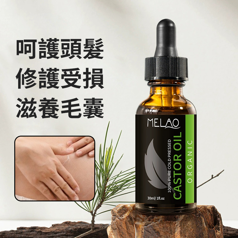 MELAO 蓖麻油頭髮護理油 頭皮護理 按摩精油 修復受損 滋養毛囊 修護頭皮 30ml [平行進口] HK2672