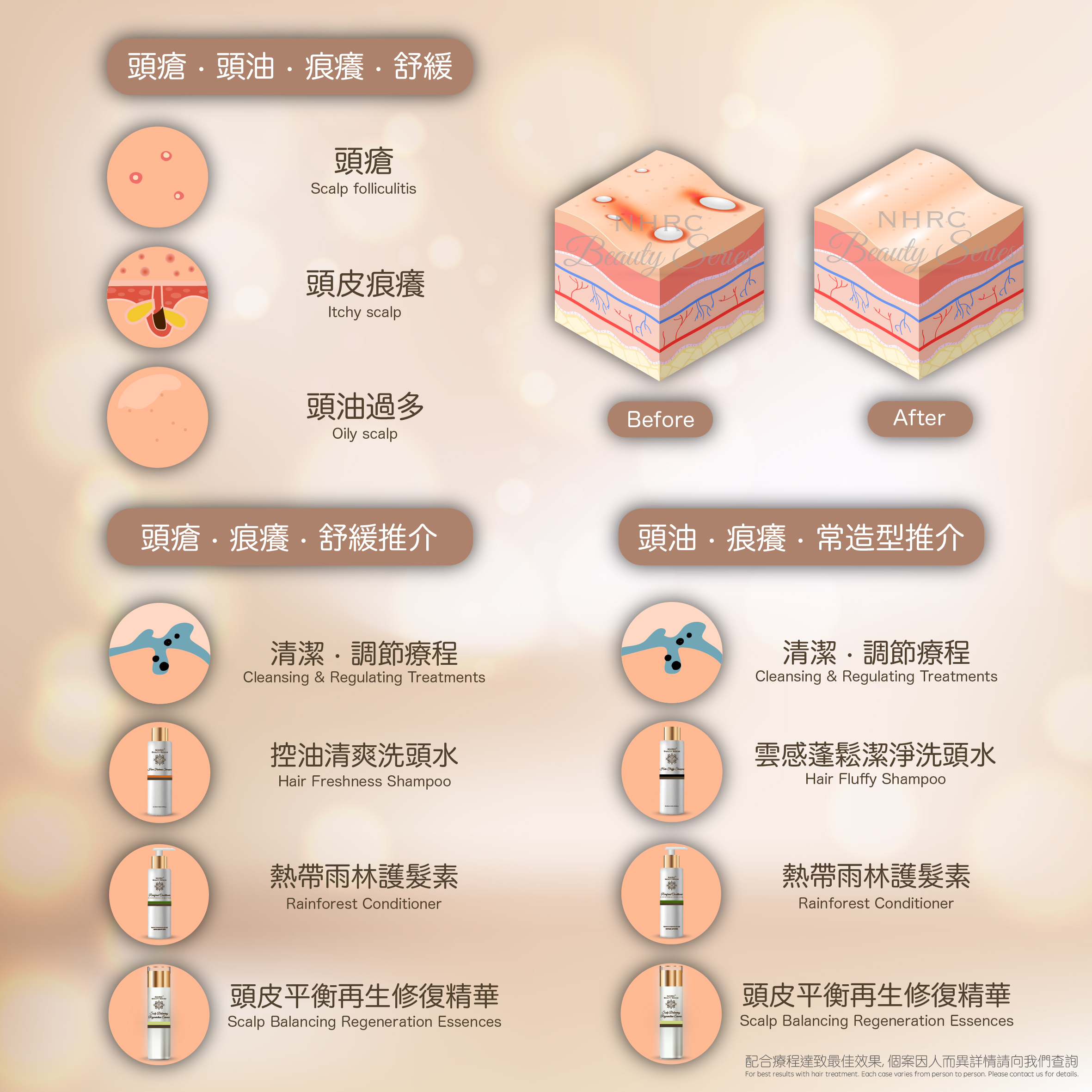 頭皮淨化抗菌去屑洗頭水 Hair Purifying Shampoo