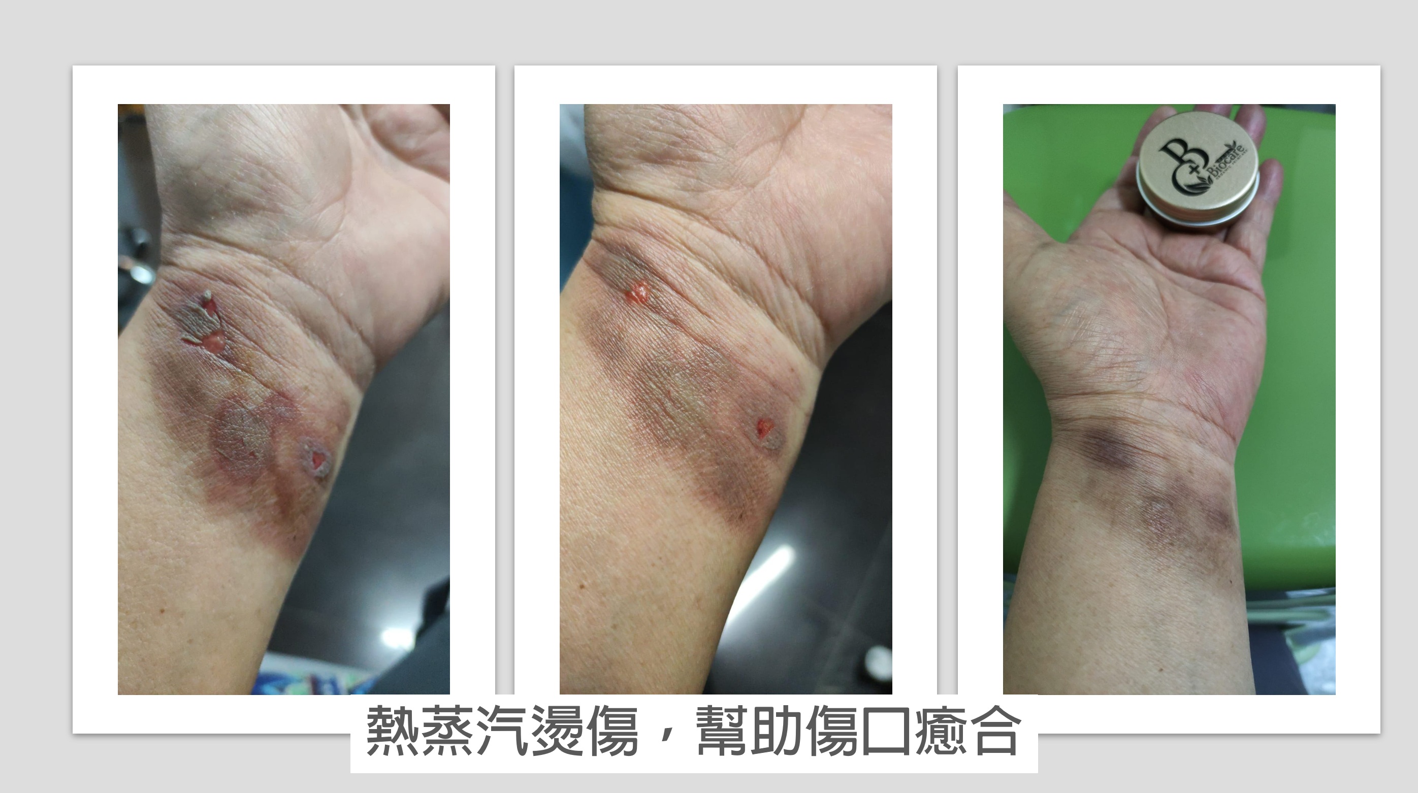 有機扁桃斑鳩菊油膏(嬰兒款)-蚊叮蟲咬/消腫止痕/濕疹/尿布疹及奶癬