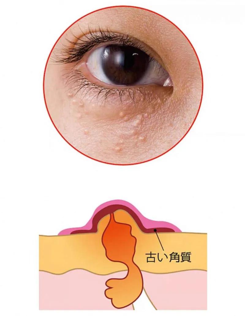 日本直送- Buhna眼周去角質粒護理霜(11g)