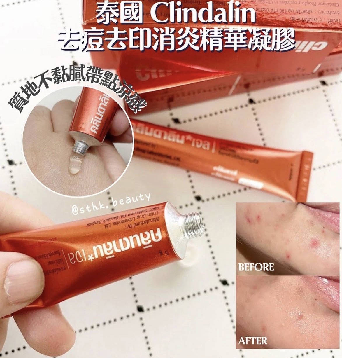 泰國 Clindalin 去痘去印消炎精華凝膠