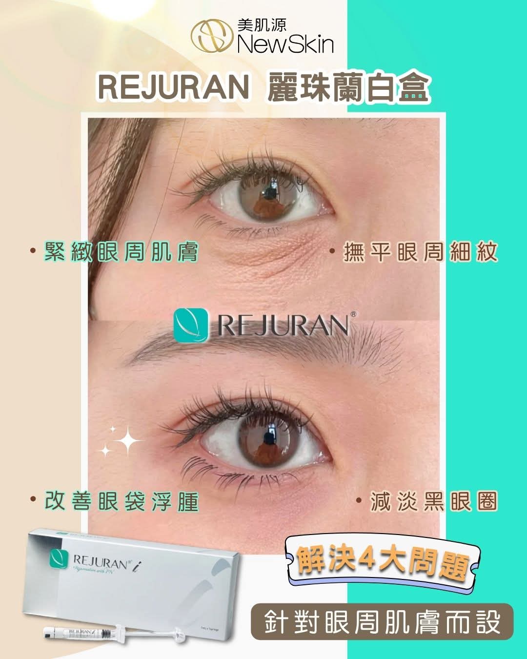 韓國最火 Rejuran麗珠蘭白盒療程