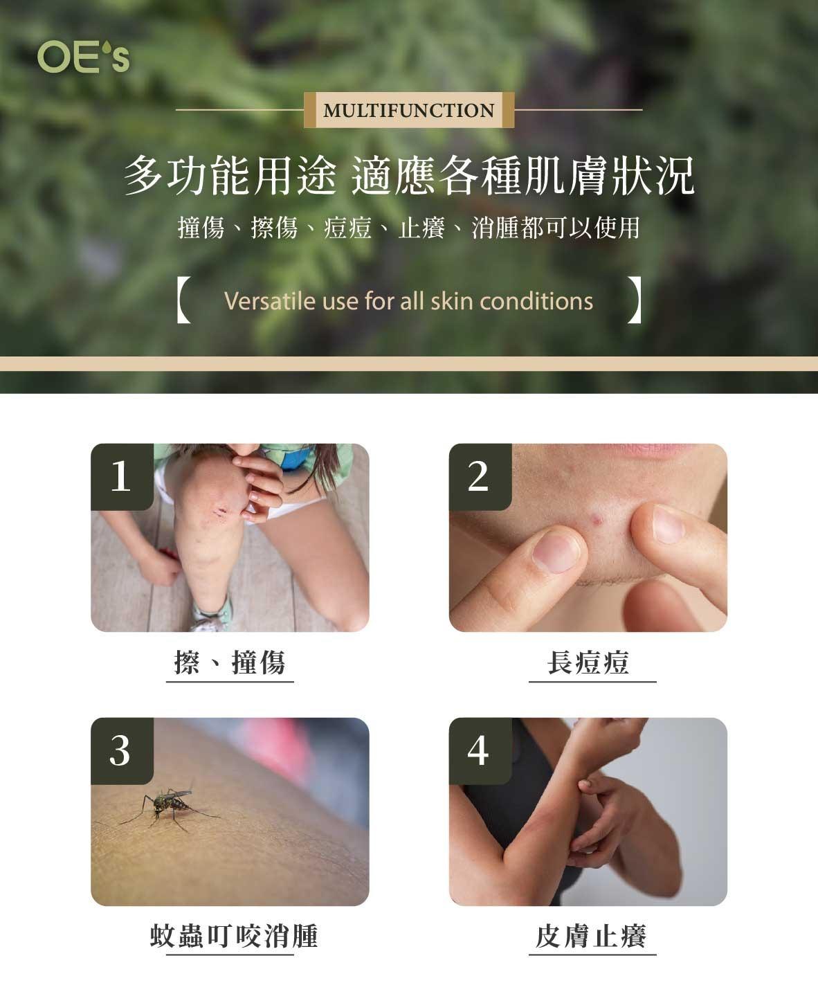 🇹🇼OE's台灣天然檜木精油膏 (2入) | 止癢消腫萬用