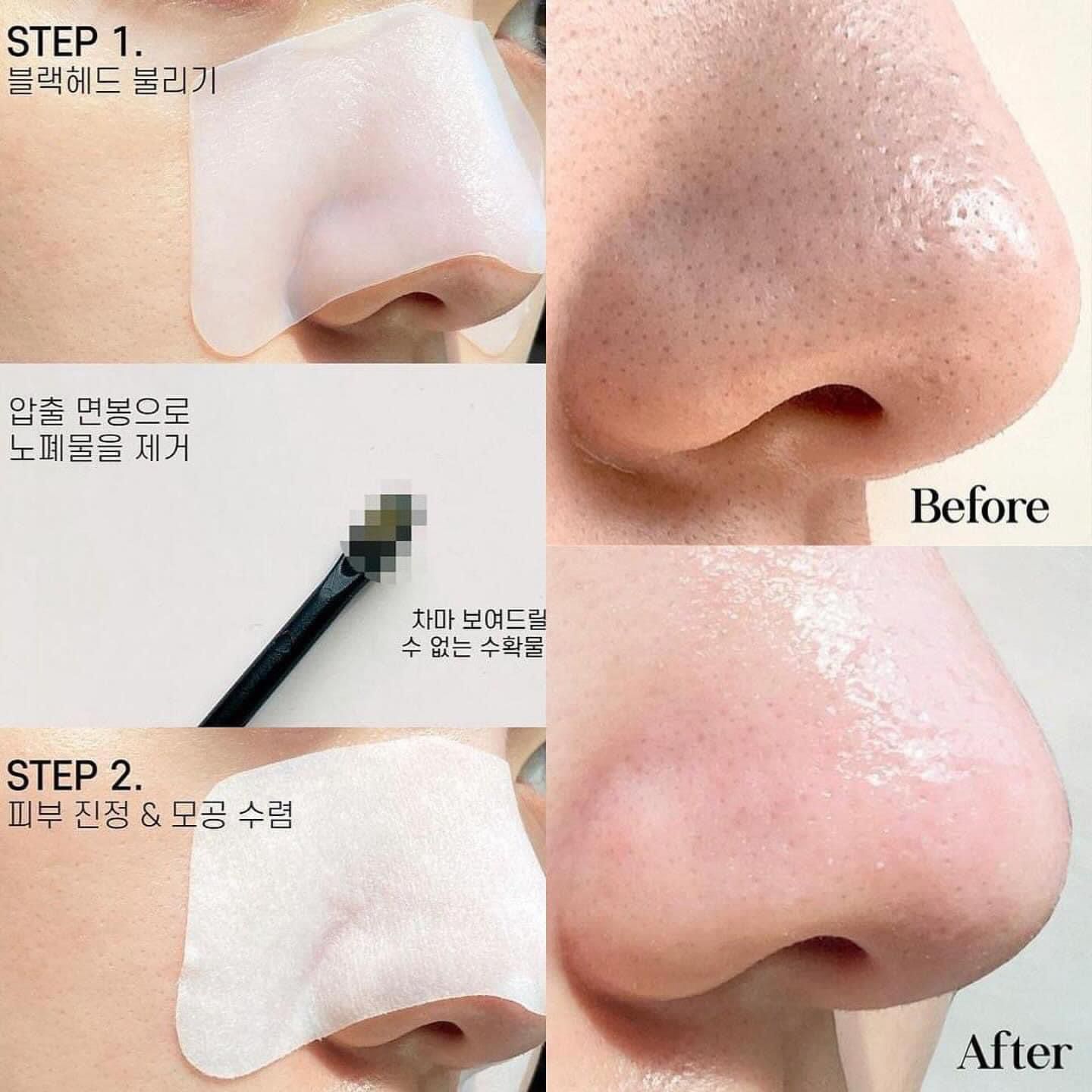 🇰🇷ilso溫和深層清潔黑頭鼻貼