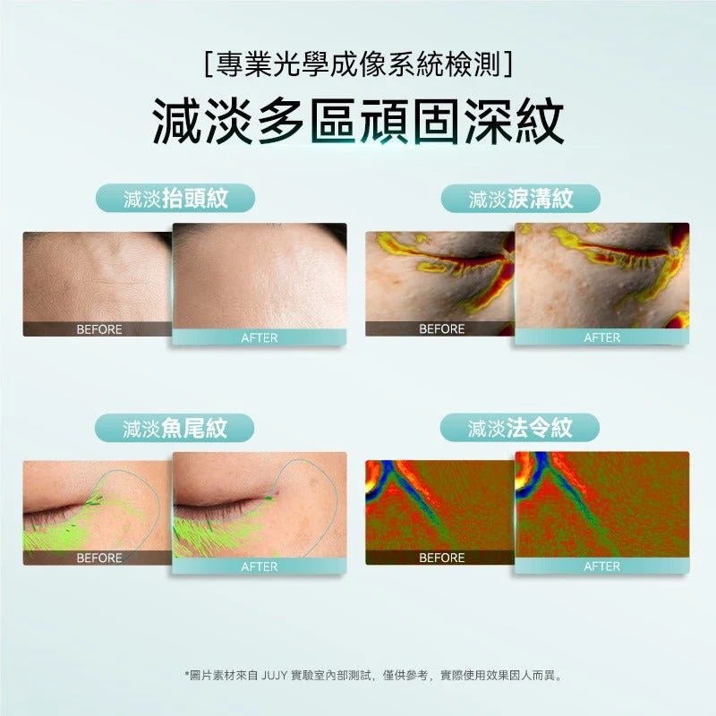JUJY小鯨玉極致煥發冰感膠原緊緻淡紋射頻儀 Pro 2.0 香港行貨 送導入GEL (訂貨4-7天)