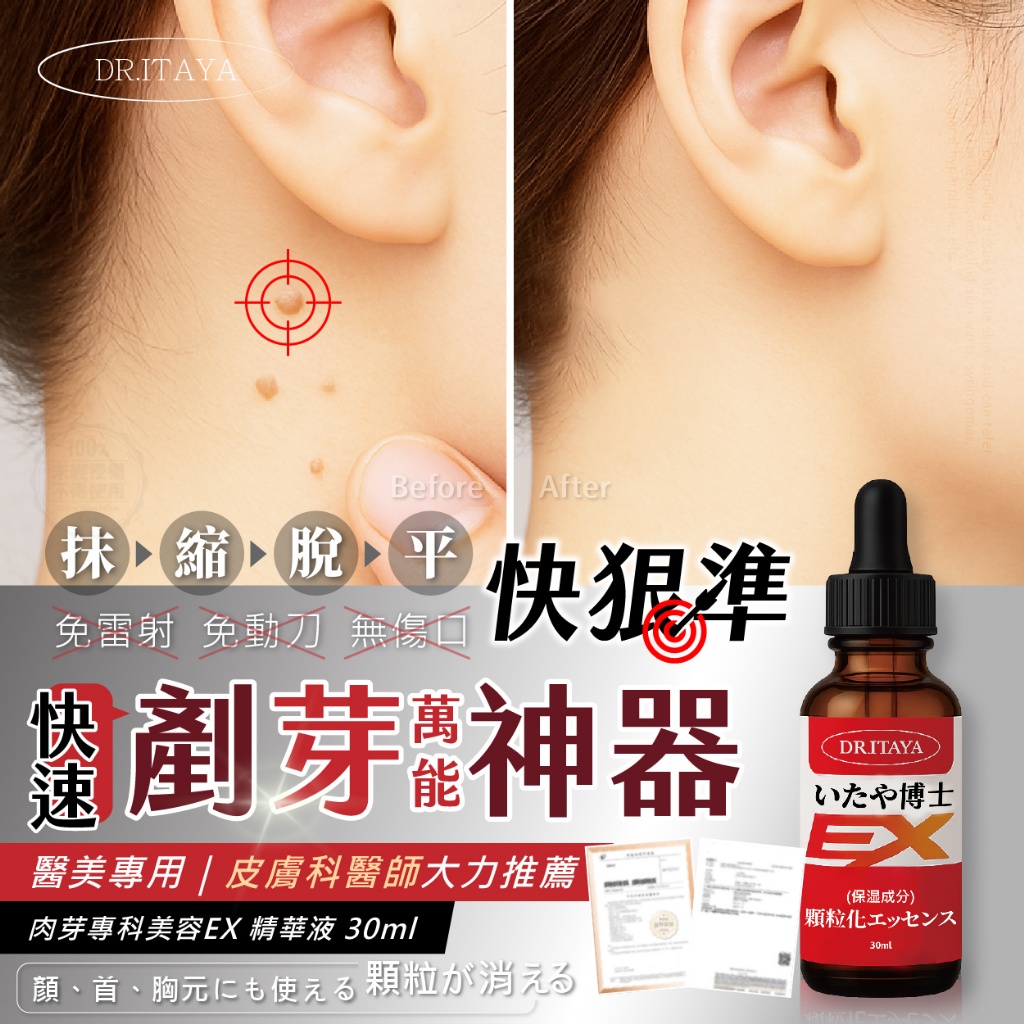 YW260192 - DR.ITAYA® 肉芽專科美容EX 精華液 30ml