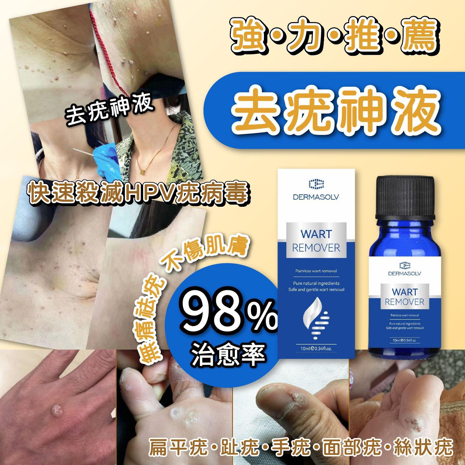 DermaSolv 強力去疣神液10ml