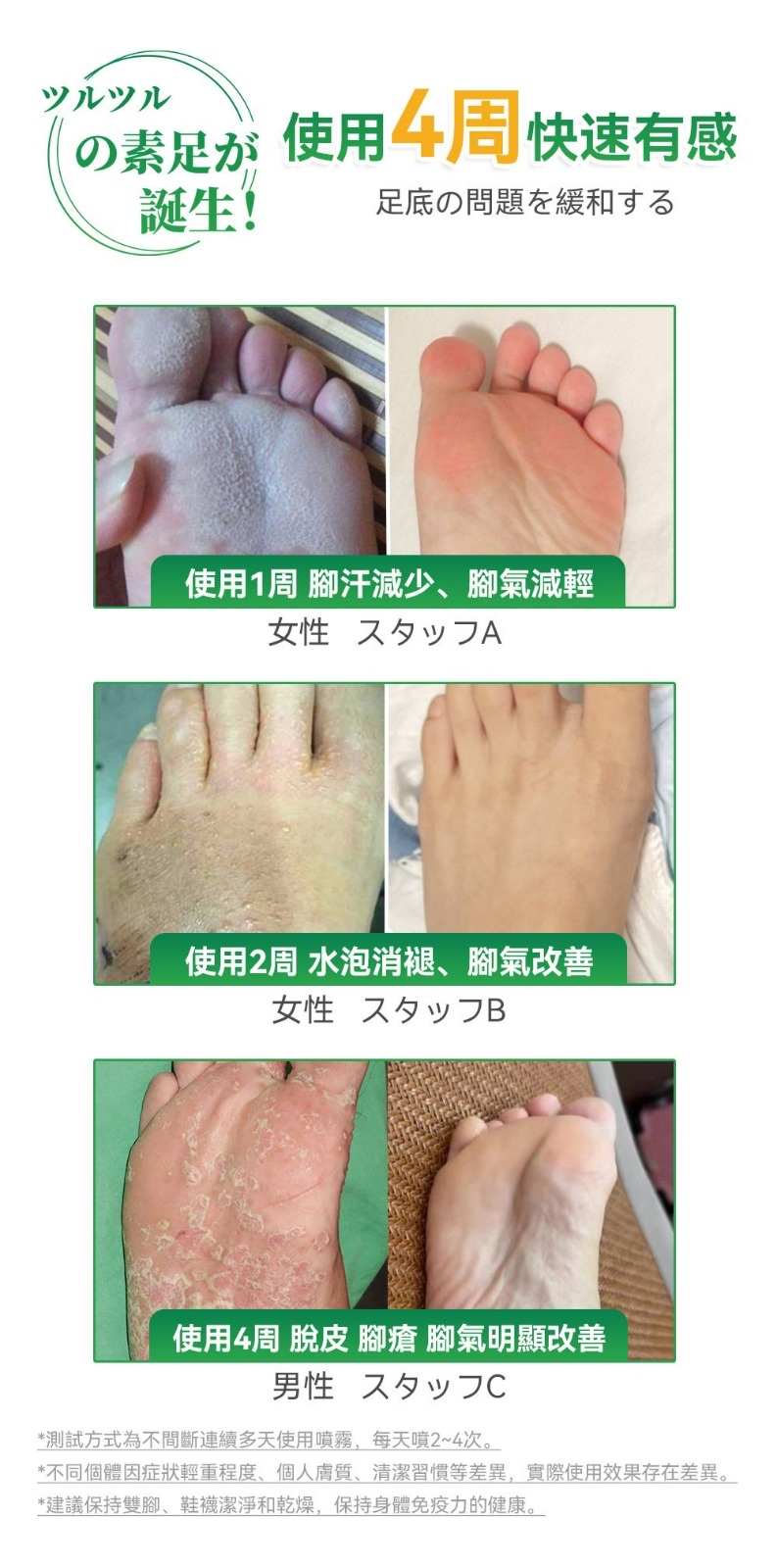 日本Healthive專研3倍抗菌脫臭植萃修護腳氣水(100ml)