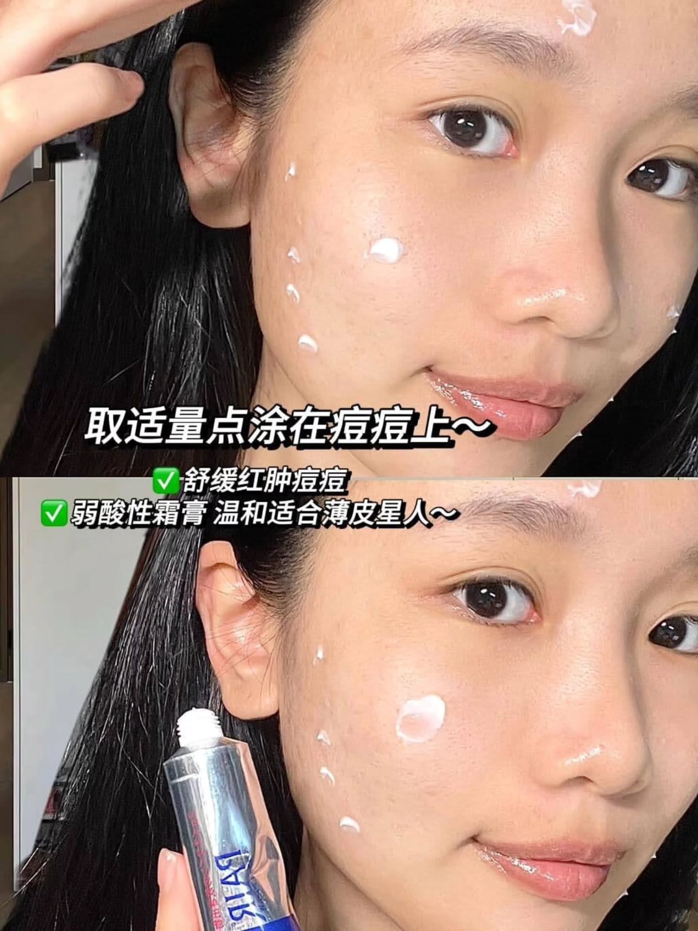 🇯🇵【日本 Pair Acne Cream 痘痘膏】