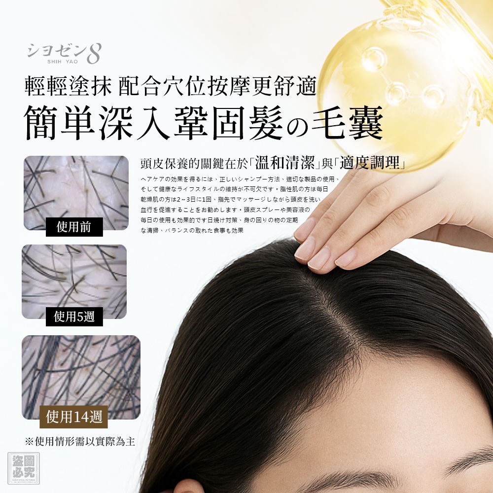 日本 シヨゼン8 頭皮煥活精華調理滾珠 20ml