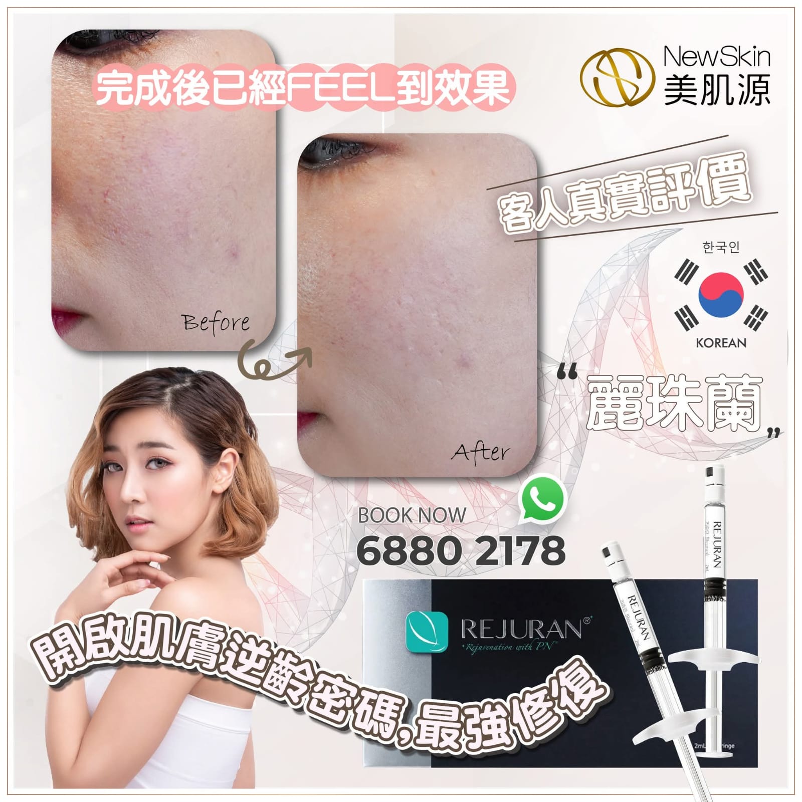 全亞洲No.1 🇰🇷韓國最火 Rejuran麗珠蘭黑盒療程