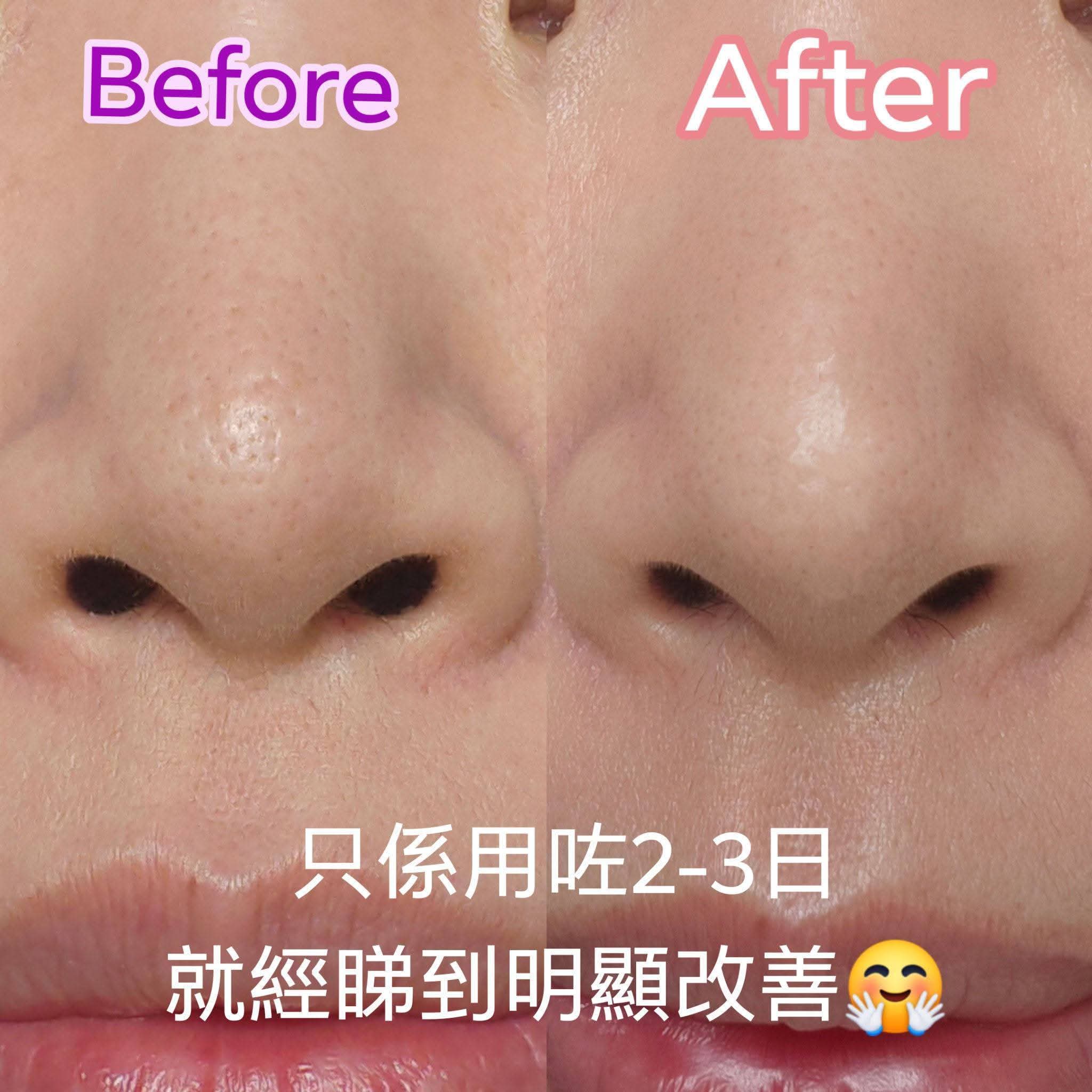 NudeSecret外泌體精華外泌體精華
