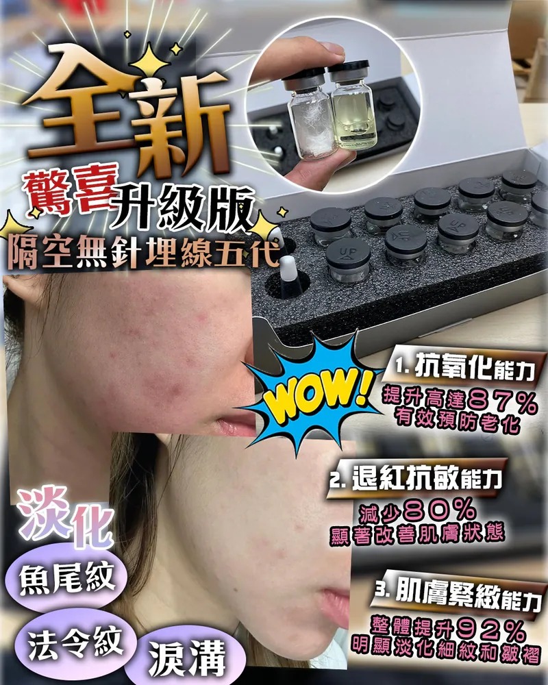 Neuface Pro 全新第5代隔空無針埋線升級版  (訂貨4-7天)