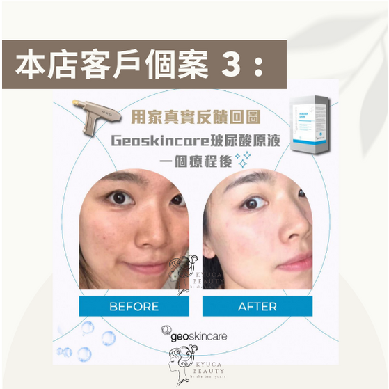 【 居家必備 】玻尿酸保濕精華原液 ( 一盒8支 )