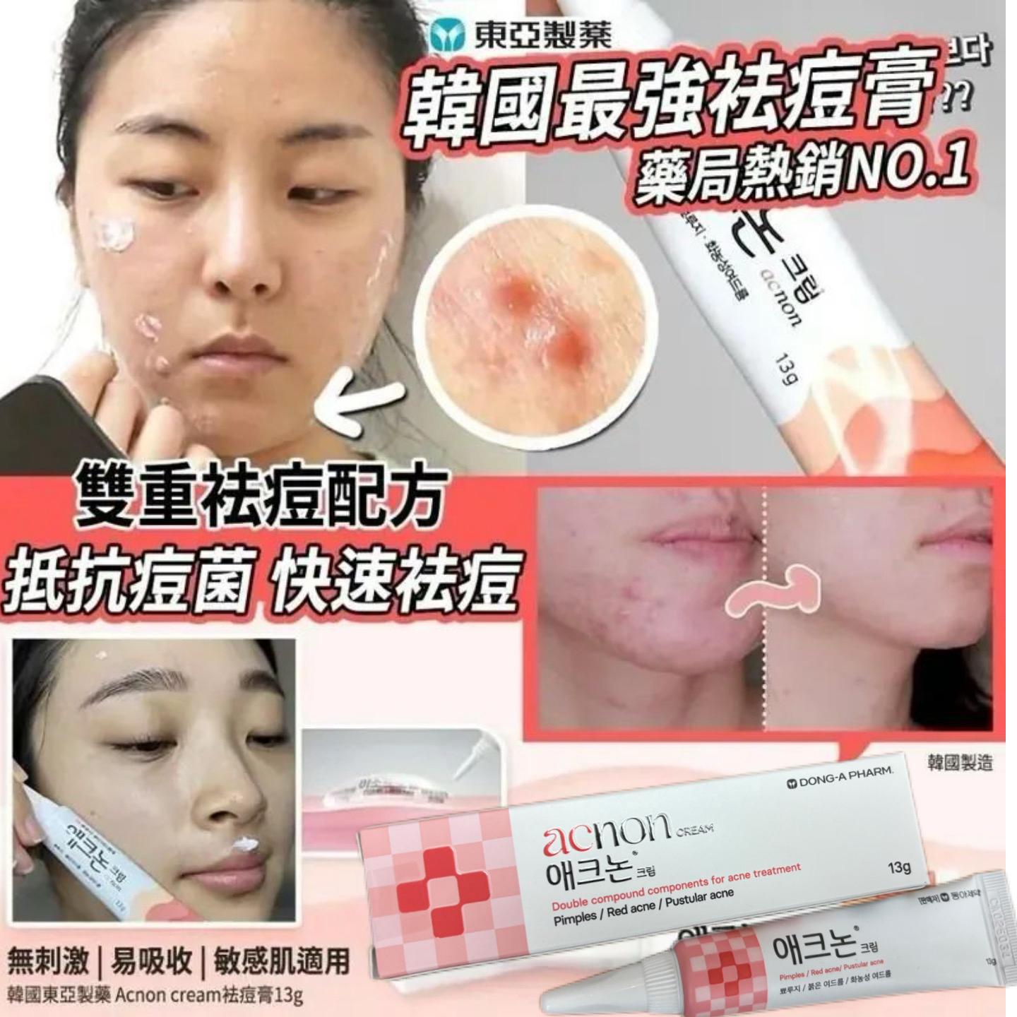 韓國東亞製藥 Acnon 消炎殺菌暗瘡膏 Acnon Cream 13g (現貨品)