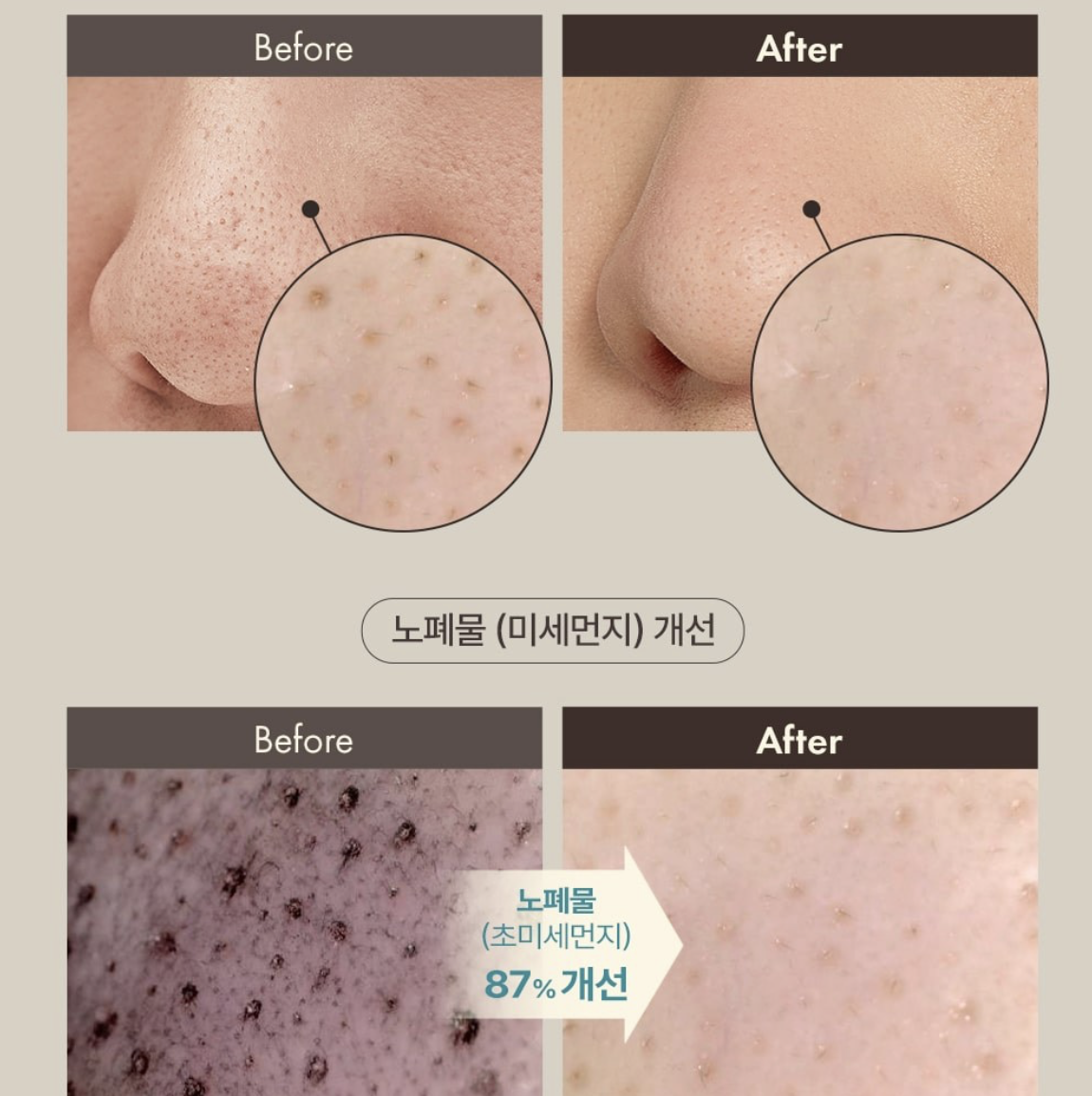 韓國 OBge 茶樹控油 黑頭清潔棒｜Blackhead Scrub Balm
