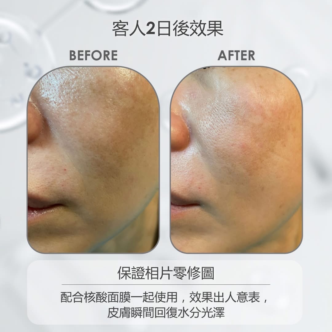 Cuthys特效嫩膚緊緻精華1盒14枝