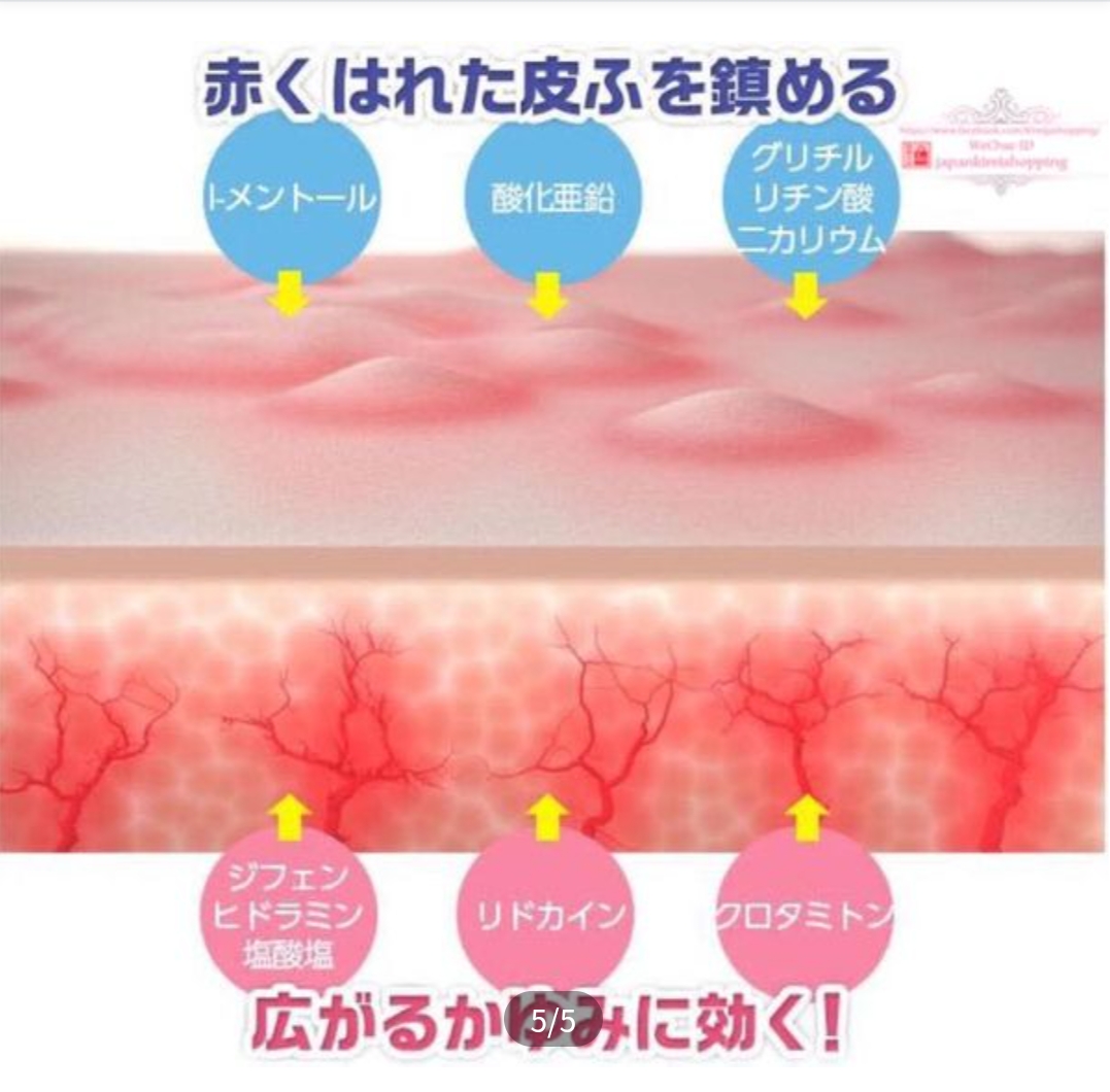 日本 曼秀雷敦 蕁麻疹濕疹軟膏 15g | 止癢抗炎 | 不含類固醇 | 濕疹、蕁麻疹適用