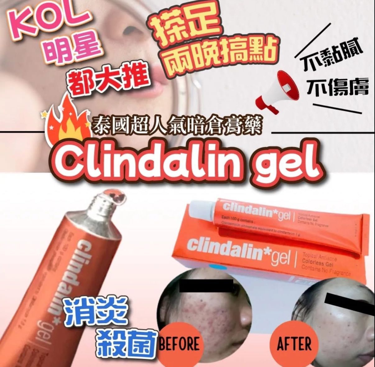 泰國熱買 Clindalin gel 暗瘡膏5g