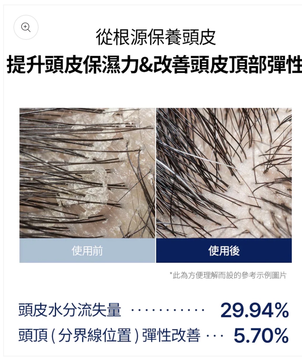 激活髮根｜GROWUS 🧬 育髮滾珠按摩精華EX