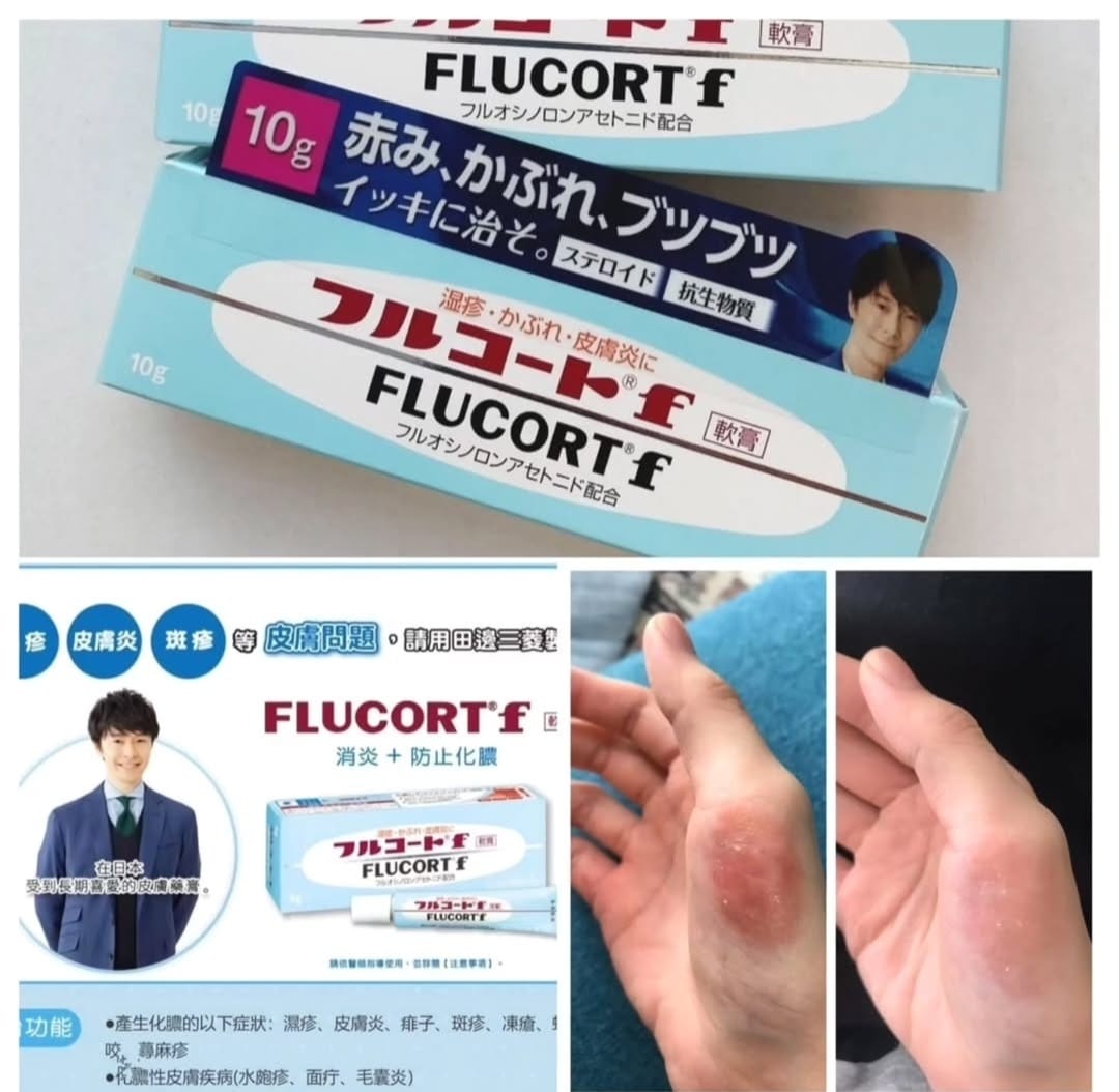 日本Flucort F 濕疹皮炎軟膏10g
