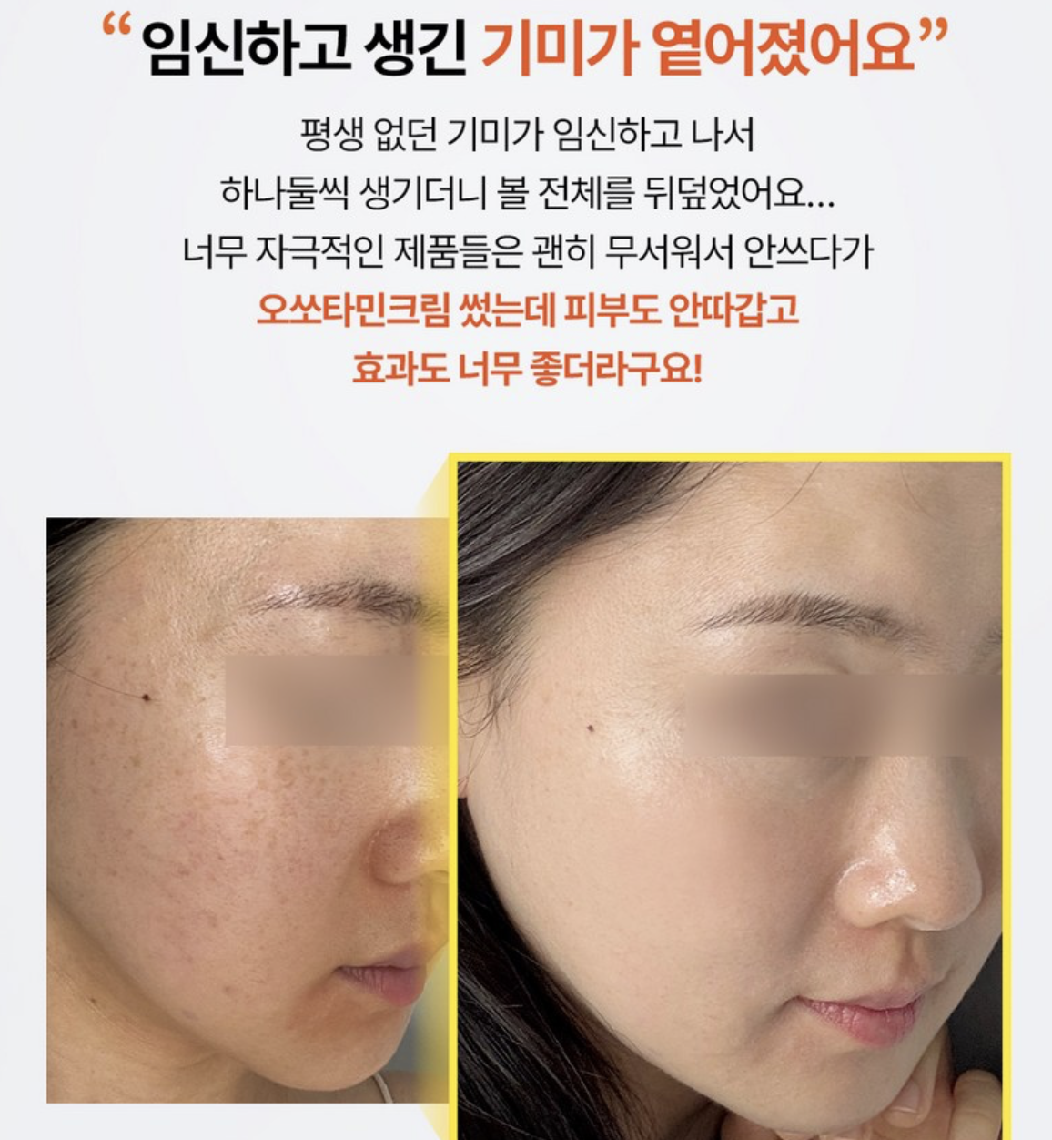韓國 Mommy Care Orthotamin 醫學級 15%高純度 純維C 淡斑美白面霜 50g / 支｜Vitamin C Cream