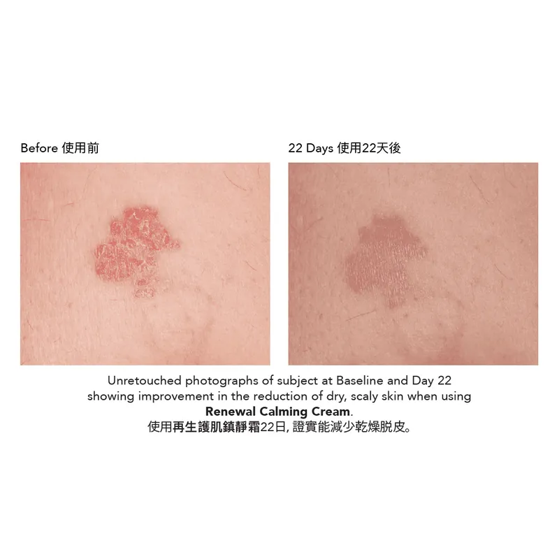 Epionce Renewal Calming Cream 再生護肌鎮靜霜