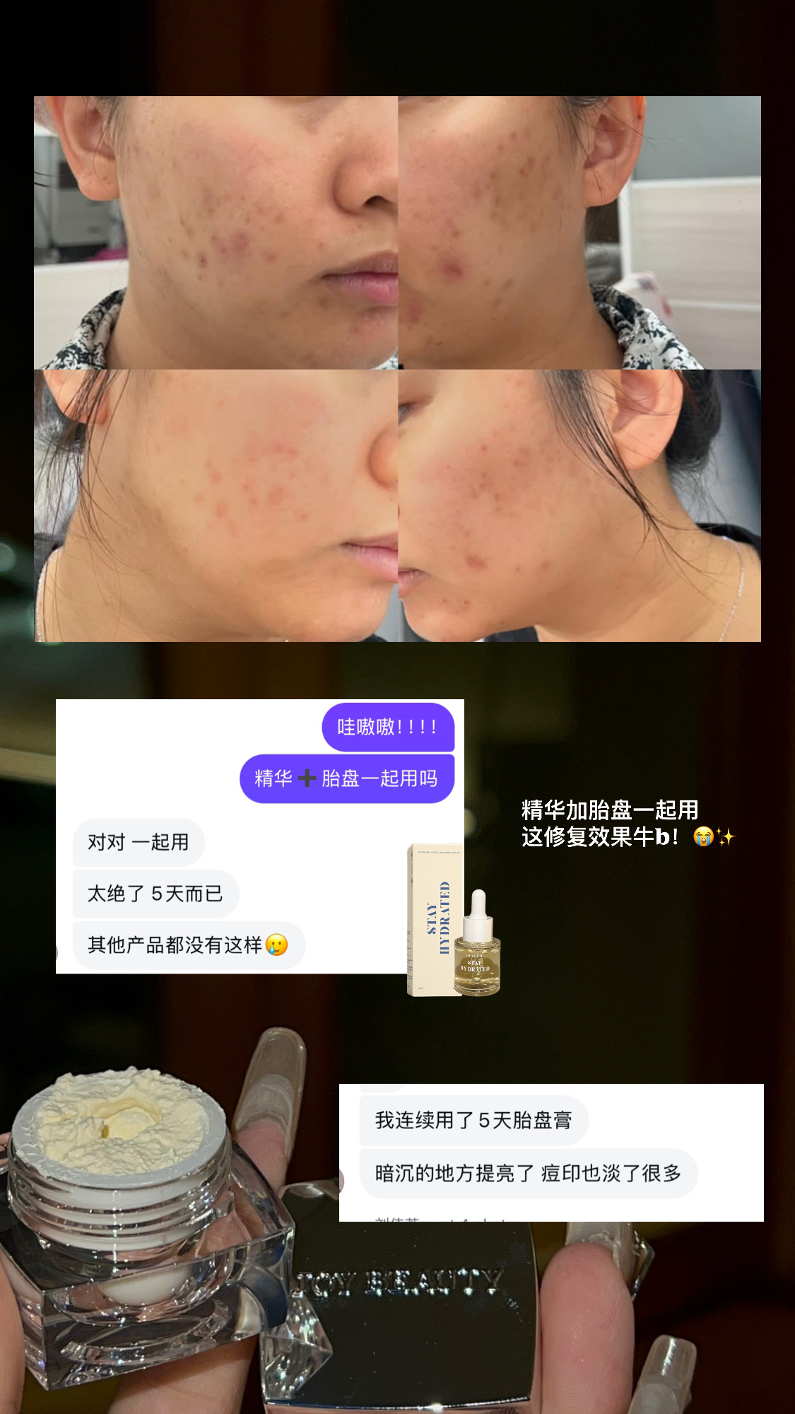 精华+胎盘膏组合（最热销）